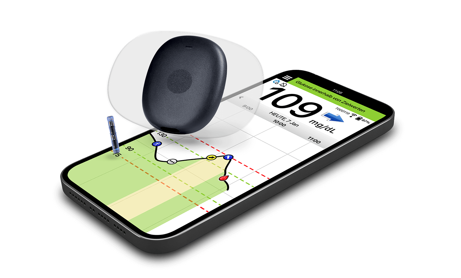 Das Eversense Langzeit-CGM Gerät schwebt über einem Smartphone, das eine App zur Glukoseüberwachung anzeigt.