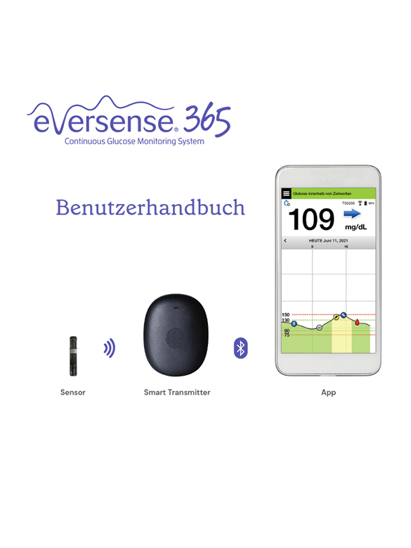Die Eversense Bedienungsanleitung zeigt eine App f&uuml;r Glukosemessger&auml;te mit einer Anzeige von 109 mg/dL, einen CGM-Sensor und einem Smart Transmitter.
